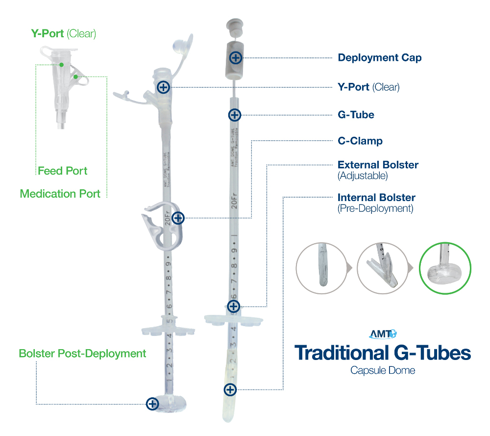 Applied Medical Technology|Capsule Dome G-Tube