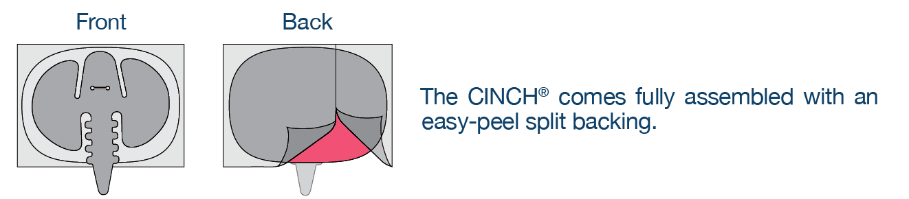 Applied Medical Technology|CINCH<sup>®</sup>